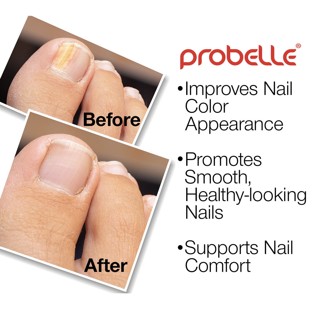 Natural Nail Renewal Gel